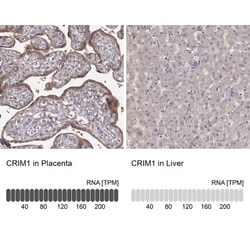 CRIM1 Antibody, Novus Biologicals 0.1mL; Unlabeled:Antibodies, Polyclonal